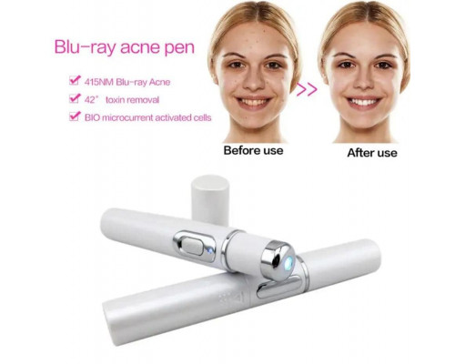 Лазерна ручка для видалення акне R A Products